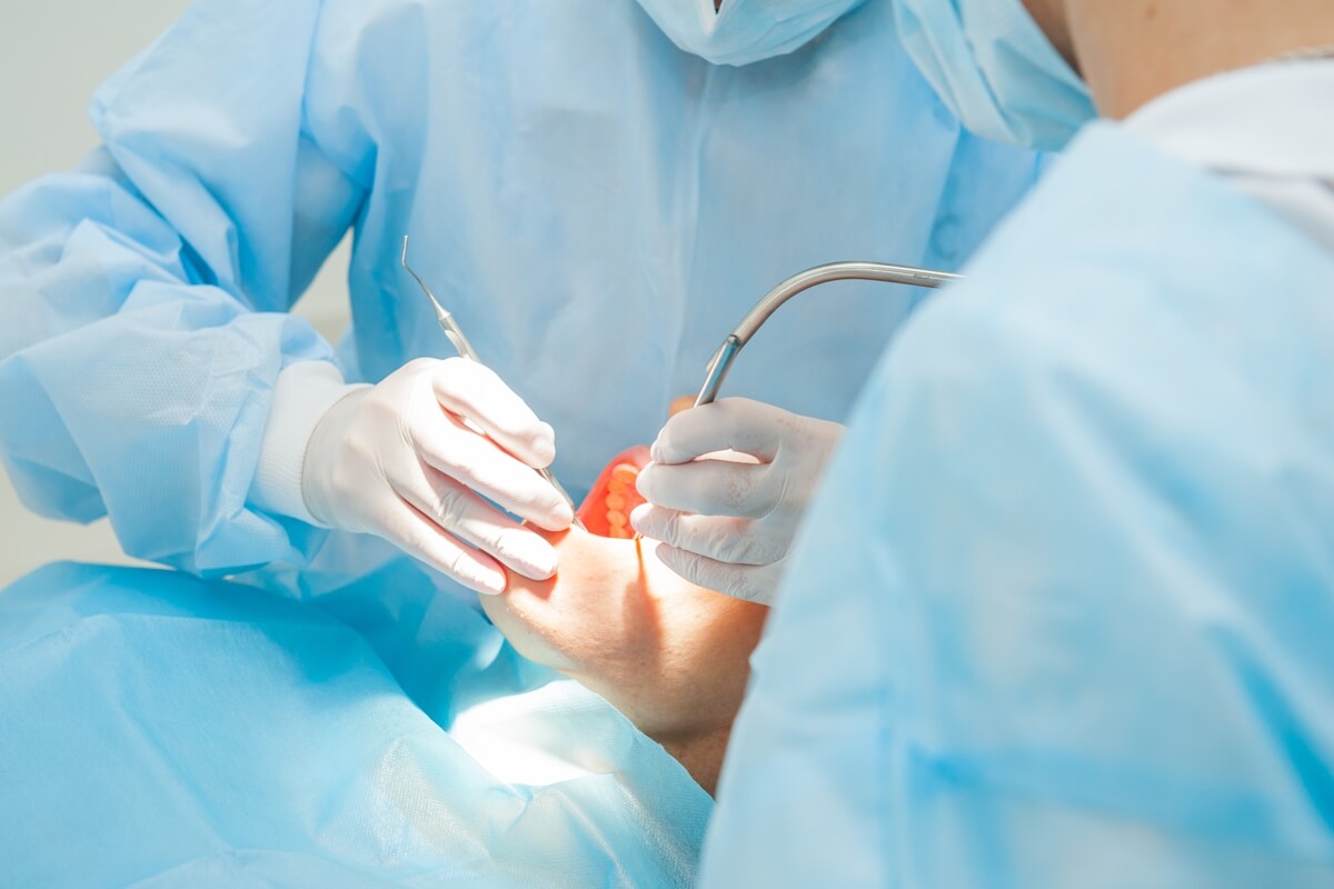 Oralchirurgie Zahnarzt Cologne